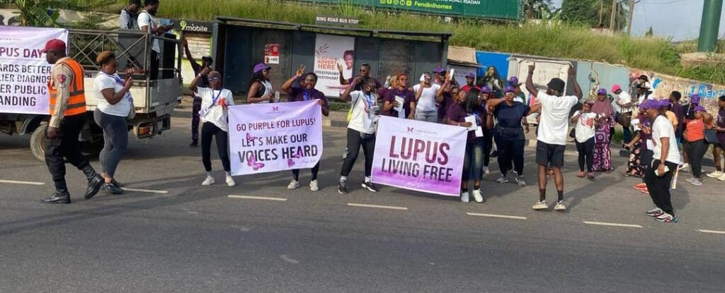 Lupus Day: Lupus Warriors NG sensitises, gives cash to patients