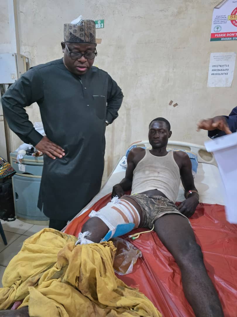 Over 50 Kaiama attack survivors receiving treatment in Ilorin — Sen. Umar